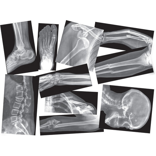 Roylco Broken Bones X-rays Set